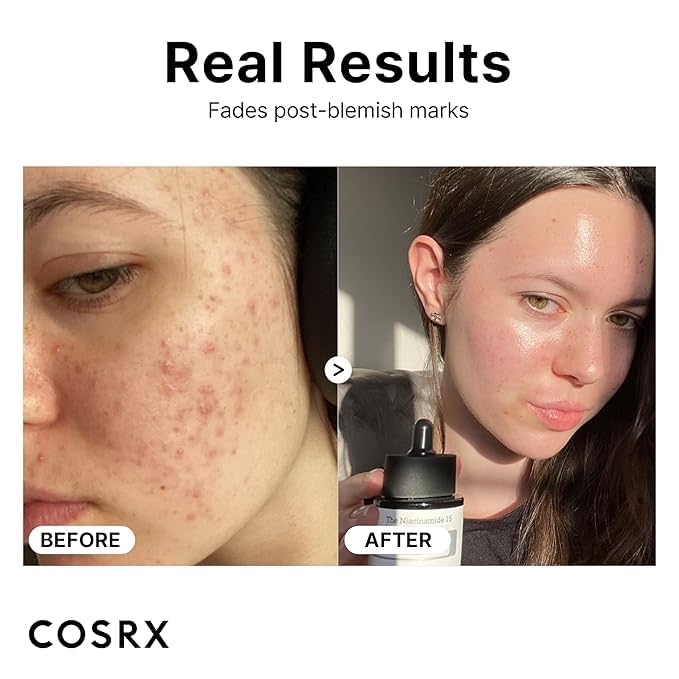 COSRX THE NIACINAMIDE 15 SERUM