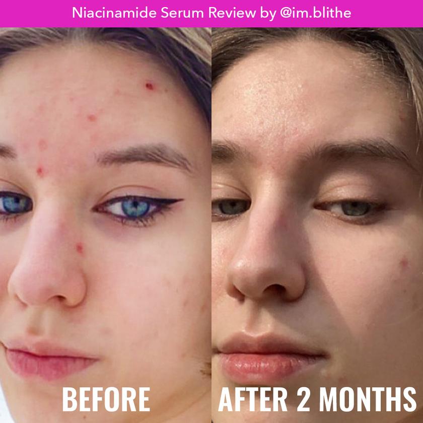 GOOD MOLECULES NIACINAMIDE SERUM